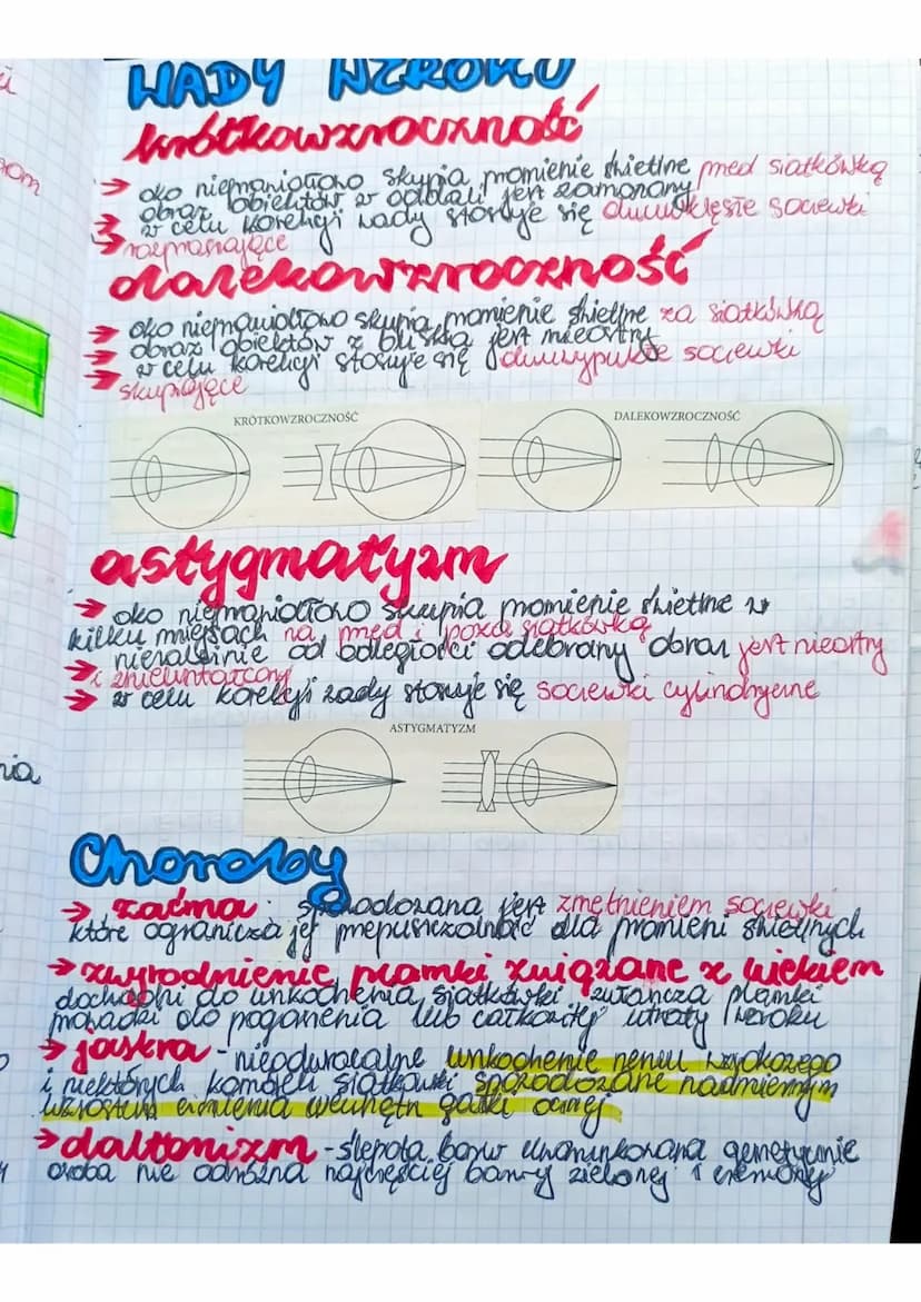 Liska
e
a
Kame
egi
BUDONA I DZIAŁANIE
NARZĄDU HEROKY
Ngradem Nzroku jest oko znajdujące się w oczoddle
się
GAZKI OCENE
• NERNU NEROKONEGO
• 