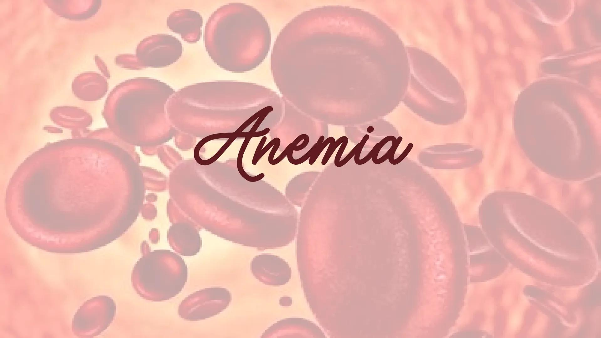 Anemia
R ANEMIA - CO TO?
Anemia to choroba przebiegająca z obniżeniem ilości
erytrocytów, czyli krwinek czerwonych. Erytrocyty to komórki
kr