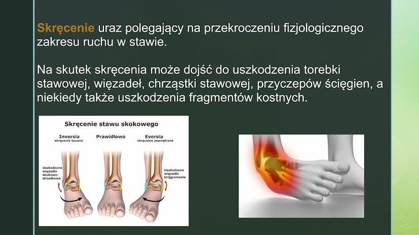 
<p>Urazy kończyn zdarzają się często. Czasami urazy, takie jak upadek na oblodzonym chodniku czy uderzenie się piłką w wyprostowany palec, 