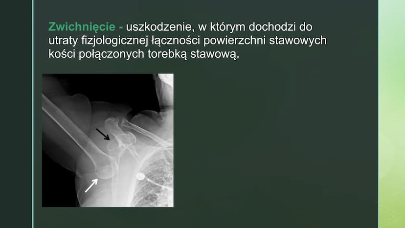 
<p>Urazy kończyn zdarzają się często. Czasami urazy, takie jak upadek na oblodzonym chodniku czy uderzenie się piłką w wyprostowany palec, 