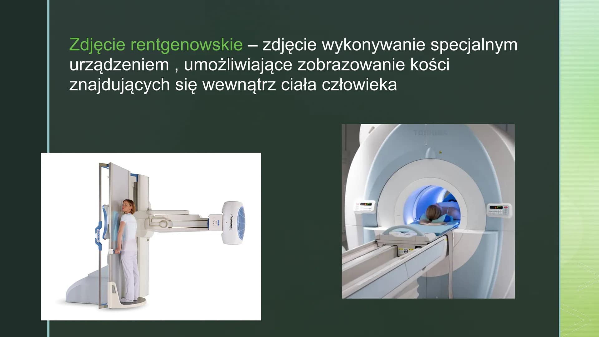 
<p>Urazy kończyn zdarzają się często. Czasami urazy, takie jak upadek na oblodzonym chodniku czy uderzenie się piłką w wyprostowany palec, 