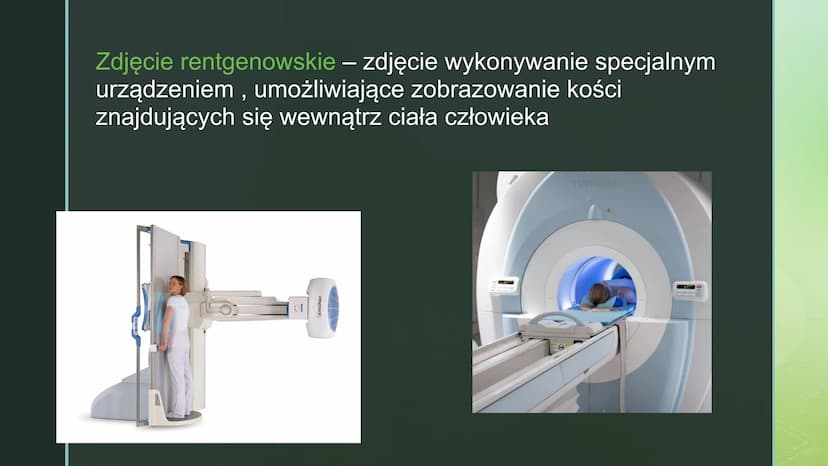 
<p>Urazy kończyn zdarzają się często. Czasami urazy, takie jak upadek na oblodzonym chodniku czy uderzenie się piłką w wyprostowany palec, 