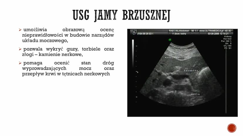 S
CHOROBY UKŁADU
MOCZOWEGO
Autor: Gabriela Boszczyk kl.3A
F
COOPERCH ▪ W ciągu doby przez nerki przepływa ok. 1500 dm³ krwi, która zostaje w