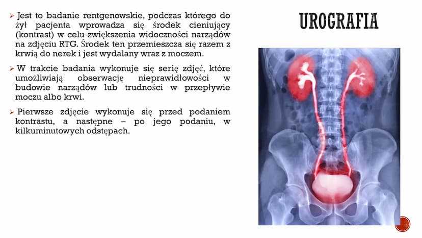 S
CHOROBY UKŁADU
MOCZOWEGO
Autor: Gabriela Boszczyk kl.3A
F
COOPERCH ▪ W ciągu doby przez nerki przepływa ok. 1500 dm³ krwi, która zostaje w