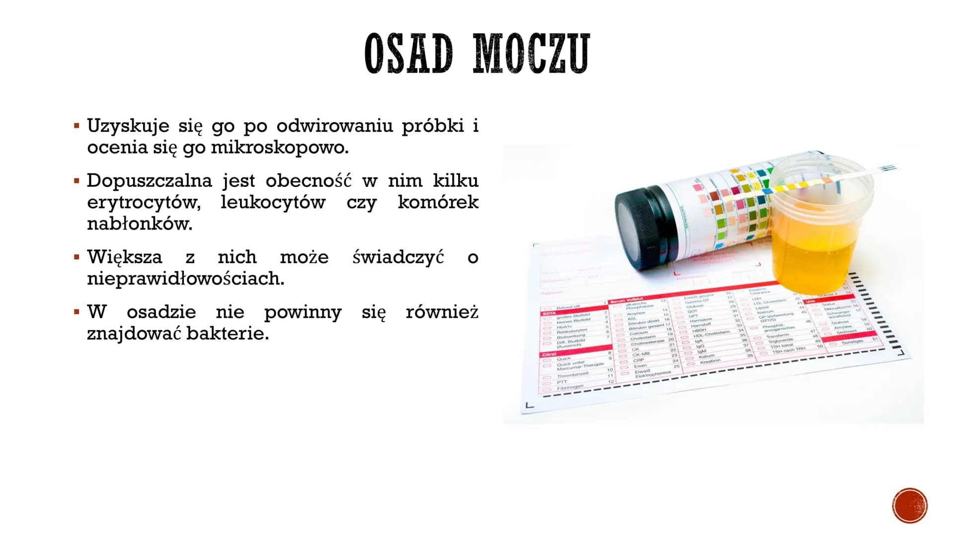 S
CHOROBY UKŁADU
MOCZOWEGO
Autor: Gabriela Boszczyk kl.3A
F
COOPERCH ▪ W ciągu doby przez nerki przepływa ok. 1500 dm³ krwi, która zostaje w