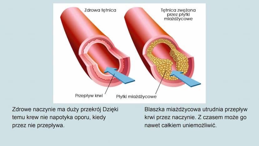 Higiena i choroby układu
krwionośnego Jak dbać o układ krwionośny?
Odpowiednia dieta,
Unikanie spożywania alkoholu i palenia papierosów,
Umi