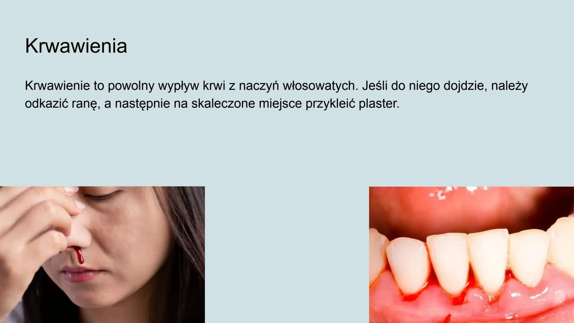 Higiena i choroby układu
krwionośnego Jak dbać o układ krwionośny?
Odpowiednia dieta,
Unikanie spożywania alkoholu i palenia papierosów,
Umi