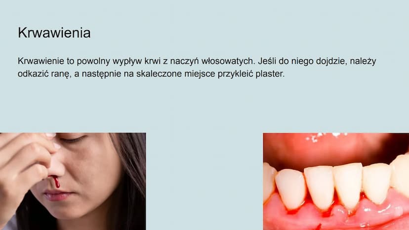 Higiena i choroby układu
krwionośnego Jak dbać o układ krwionośny?
Odpowiednia dieta,
Unikanie spożywania alkoholu i palenia papierosów,
Umi