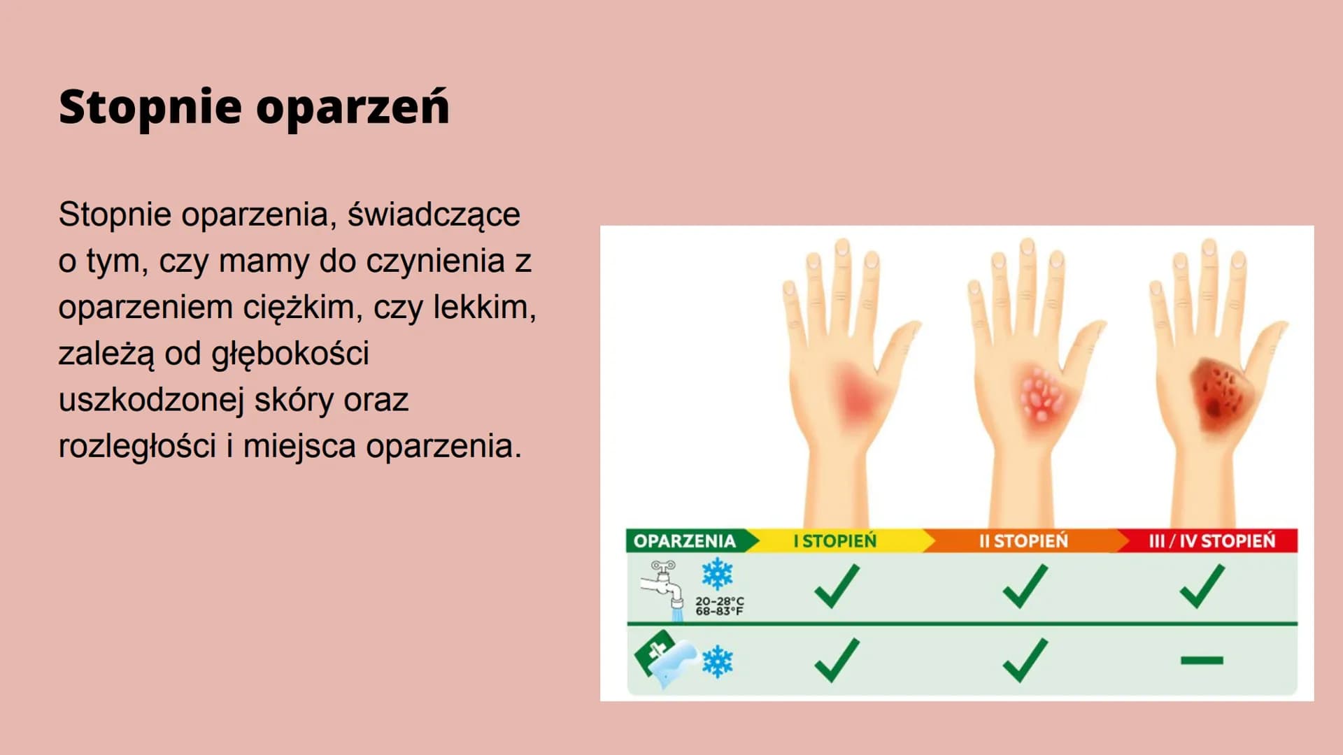 Oparzenia Co to oparzenie?
Oparzenie to - w zależności od głębokości - uszkodzenie skóry lub głębiej
położonych narządów na skutek działania