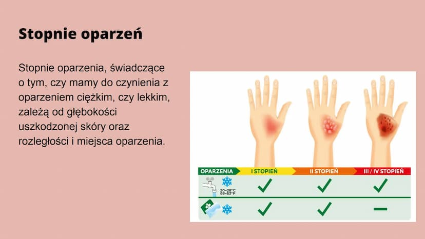 Oparzenia Co to oparzenie?
Oparzenie to - w zależności od głębokości - uszkodzenie skóry lub głębiej
położonych narządów na skutek działania