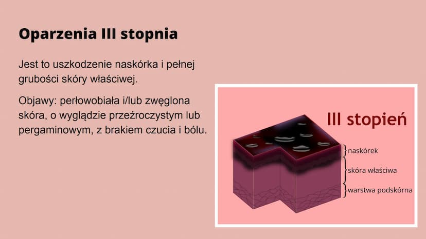 Oparzenia Co to oparzenie?
Oparzenie to - w zależności od głębokości - uszkodzenie skóry lub głębiej
położonych narządów na skutek działania