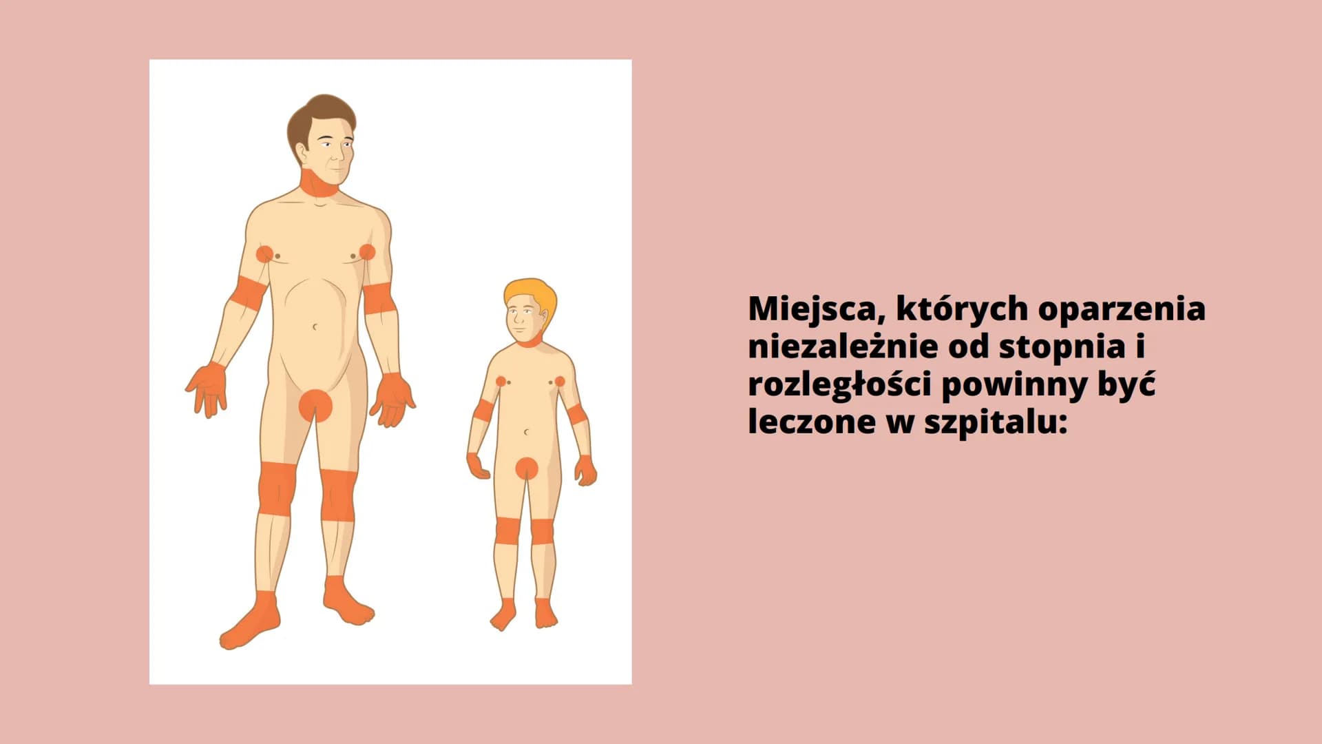 Oparzenia Co to oparzenie?
Oparzenie to - w zależności od głębokości - uszkodzenie skóry lub głębiej
położonych narządów na skutek działania