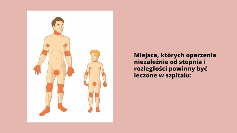 Oparzenia Co to oparzenie?
Oparzenie to - w zależności od głębokości - uszkodzenie skóry lub głębiej
położonych narządów na skutek działania