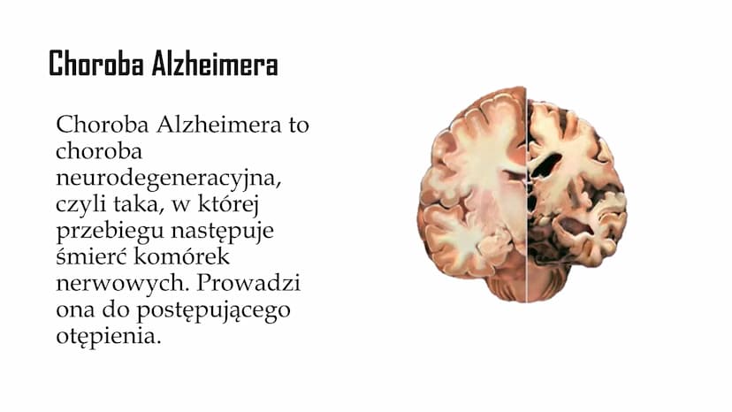 
<p>Choroba Alzheimera to neurodegeneracyjna choroba, która prowadzi do postępującego otępienia. W przebiegu tej choroby w mózgu powstają ni
