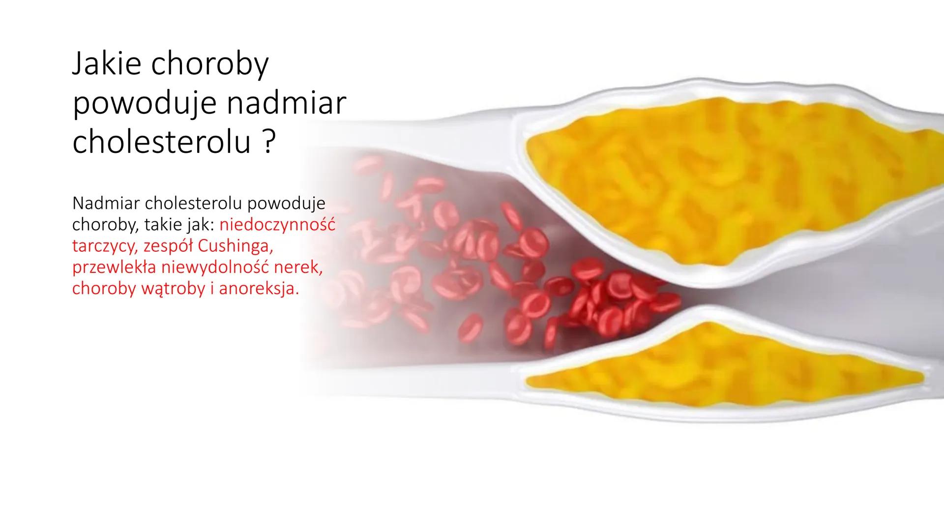 Cholesterol # Czym jest cholesterol ?

Cholesterol to związek należący do tłuszczów, niezbędny
do prawidłowego funkcjowaniu organizmu i jest