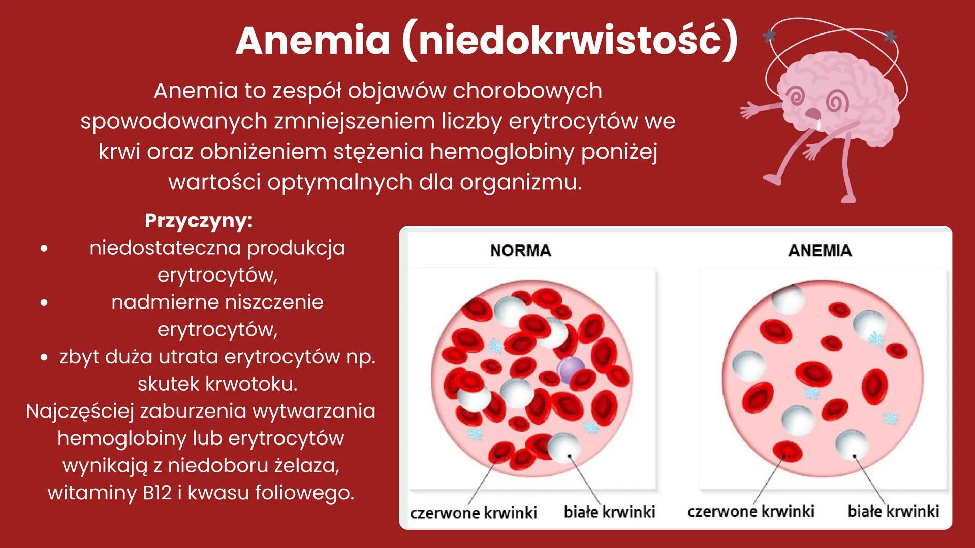 CHOROBY UKŁADU
KRĄŻENIA + Układ krążenia - definicja
Układ krążenia, znany również jako układ
sercowo-naczyniowy, to złożony system
biologic