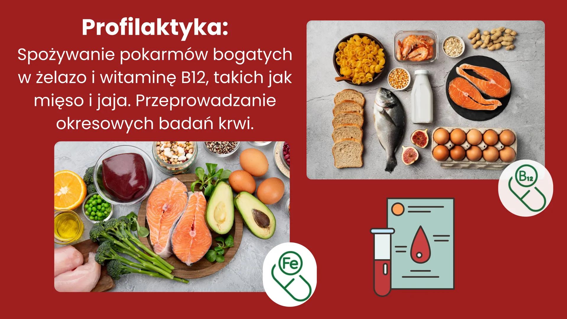CHOROBY UKŁADU
KRĄŻENIA + Układ krążenia - definicja
Układ krążenia, znany również jako układ
sercowo-naczyniowy, to złożony system
biologic