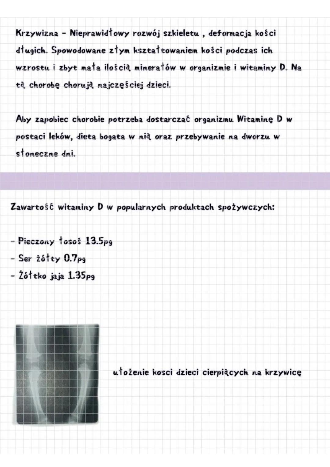 HIGIENA I CHOROBY APARATU RUCHU
1. Postona ciała
Lordoza
Kręgosłup ma swoje maturalne krzywizny.
Zaliczają się do nich
Kifoza
Lordoza (wygię