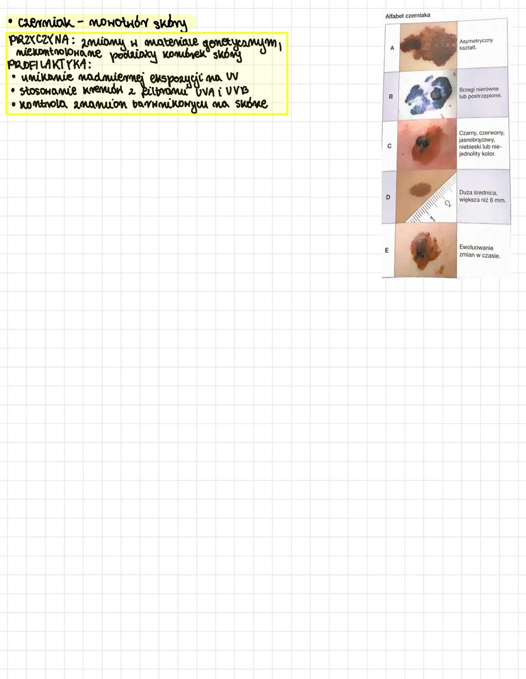 # Higiena i choroby skóry
• dziedzina medycyny zajmująca się chorobani skóry - dermatologia
## Higiena skóry
• stosowanie kremón 2 filtra